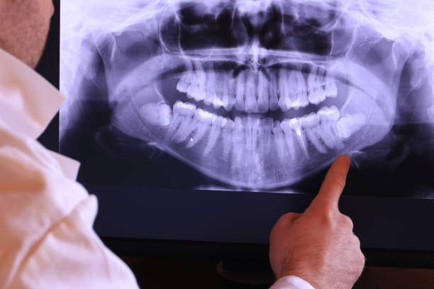 Best Mobile Emergency Dentist in Monahans, TX