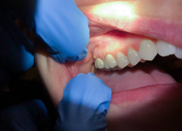 Best Emergency Root Canal Treatment in Monahans, TX