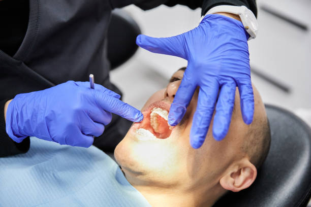Best Emergency Root Canal Treatment in Monahans, TX