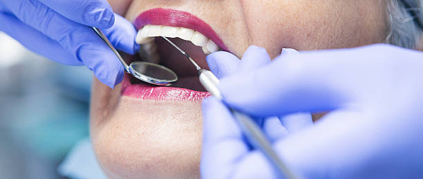Best Emergency Dental Extractions in Monahans, TX